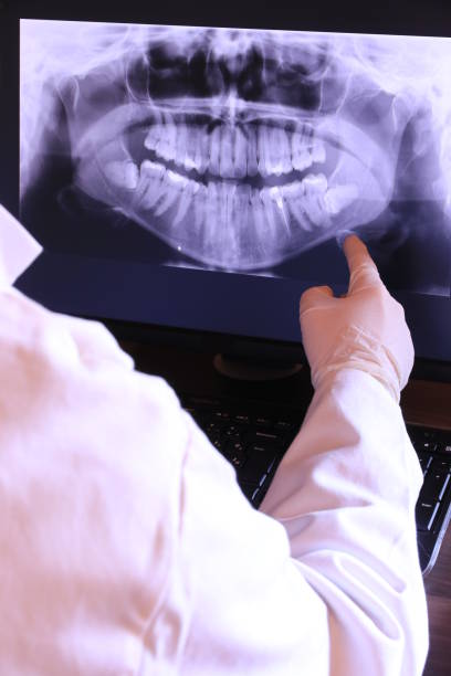 Best Emergency Dental Care for Broken or Chipped Teeth in Santa Rosa, CA