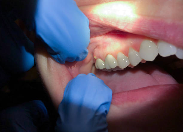 Best Weekend Emergency Dentist in Santa Rosa, CA