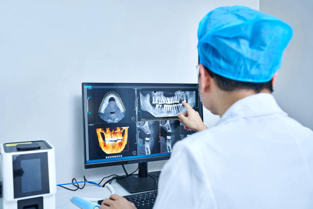 Best Emergency Treatment for Dental Infections or Abscesses in Santa Rosa, CA