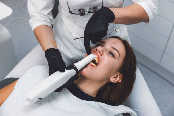 Best Emergency Wisdom Teeth Removal in Santa Rosa, CA